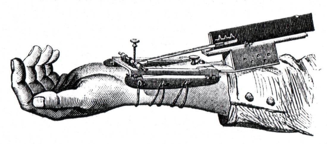 Gravure ancienne d'un sphygmographe fixé sur l'avant-bras, stylet appuyé sur l'artère du poignet